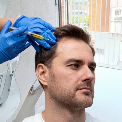 PRP Capilar (Plasma Rico en Plaquetas para Caída del Cabello y Salud Capilar)