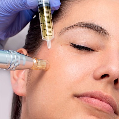 Terapia con Exosomas – Regeneración celular y reparación de la piel