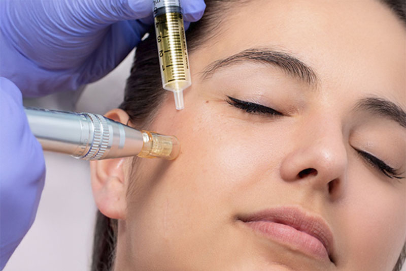 Terapia con Exosomas – Regeneración celular y reparación de la piel