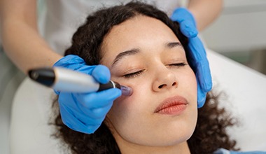 dermapen tratamiento facial medellin