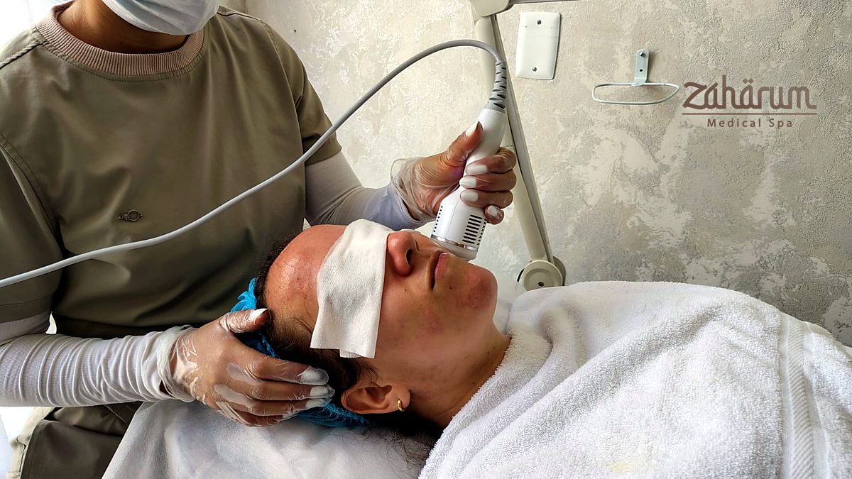 Radiofrecuencia facial para reafirmar la piel en El Poblado Radiofrecuencia facial para reafirmar la piel en El Poblado